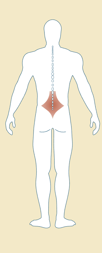 Body diagram highlighting restricted lumbar fascia mobility